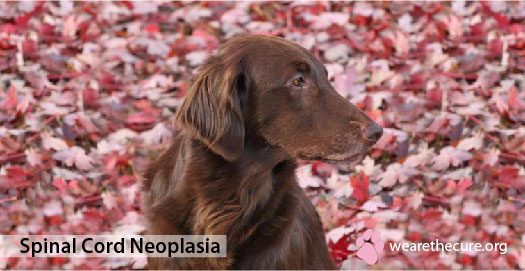 Spinal Cord Neoplasia